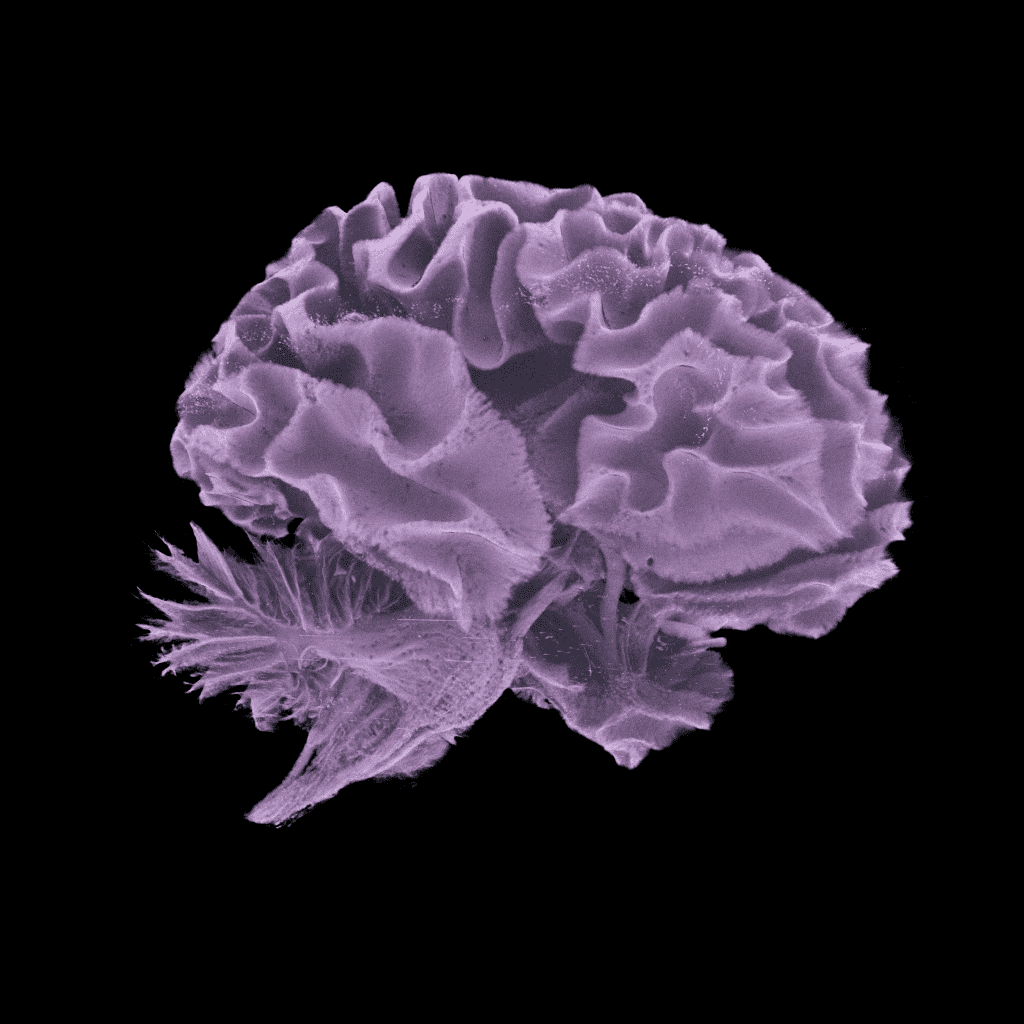 Imagem de um cérebro humano de um doador, visualizada em raio-X