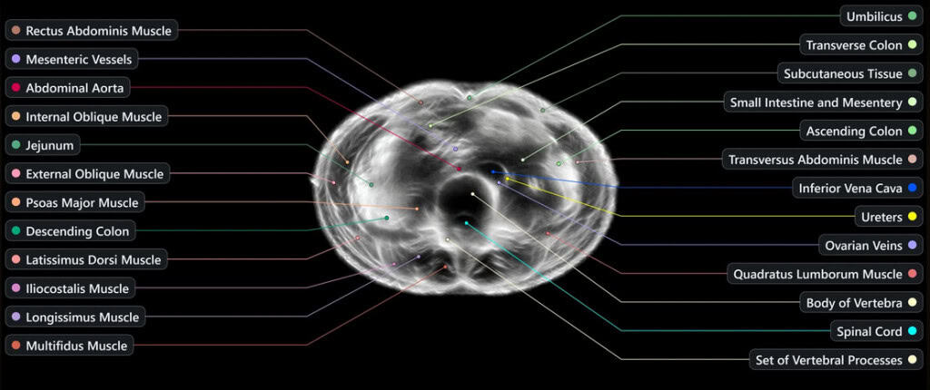 Midjourney scanner